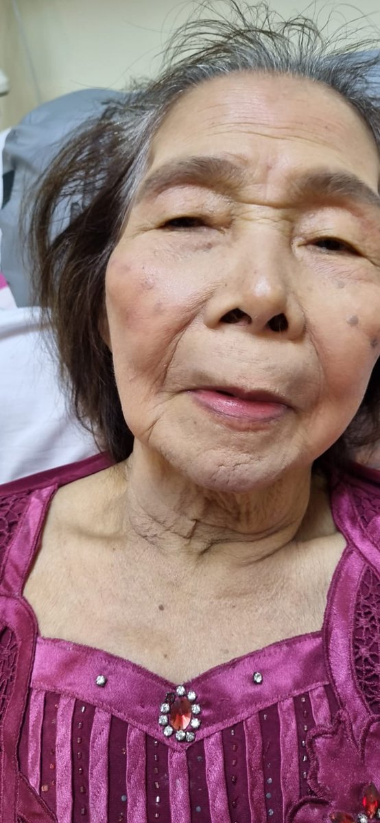 DeviMuliana14's tweet photo. Terimakasih Bhante Upasamo &amp; Umat Vihara Metta Palmerah, Jakarta yang udah menyempatkan waktu &amp; meluangkan waktunya untuk menjenguk Omaku yang sedang di rawat di RS 🙏🙏🙏🙂 10 Des 2023..           
Semoga Omaku yang bernama Ratina Wijaya cepat sembuh sadhu sadhu sadhu 🙏🙏🙏🙂.. https://t.co/o4VsgTZPwF