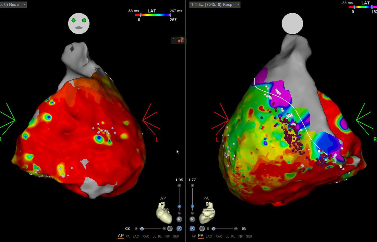 EPWaveDoc tweet picture