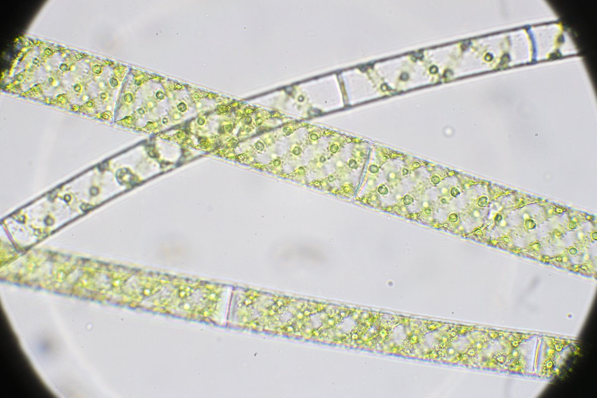 Eudorina_ch's tweet photo. 本日の3種森
#アオミドロ
#Spirogyra https://t.co/oBtmNNUDjU