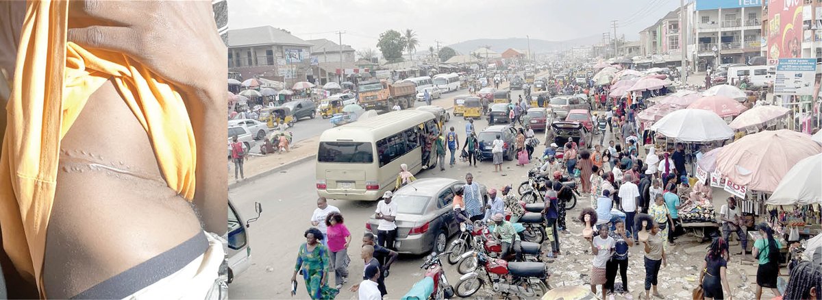 Investigation: Inside Abuja’s Kidney ‘Market’ Where The Rich Prey On The Poor
dailytrust.com/investigation-…