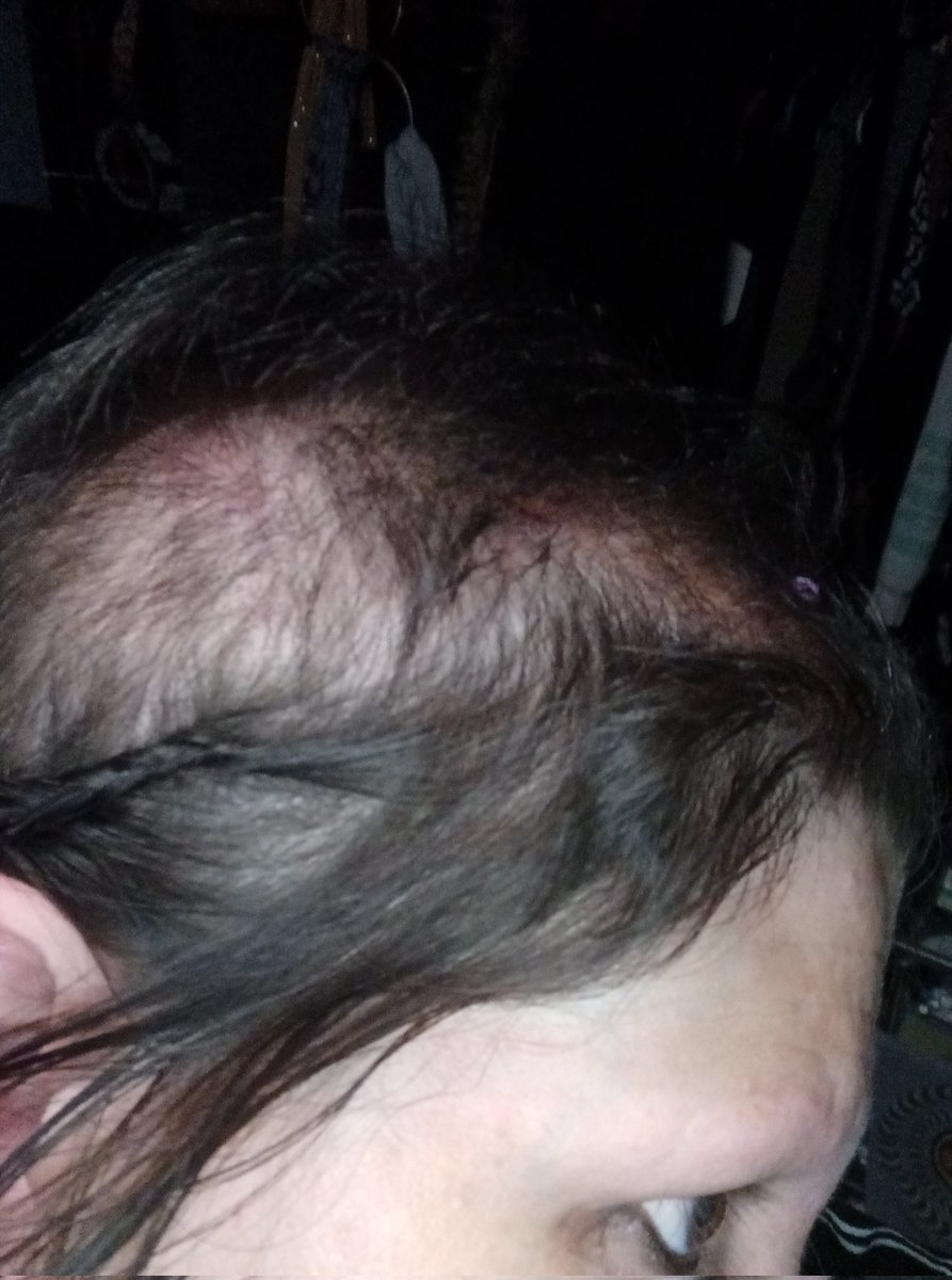 slashtag1's tweet photo. Done with seismic scalar microwave and ultrasonic frequency on 5g loopback electro current elastic static hurts alot #mutilation https://t.co/BVFpqmIAMn