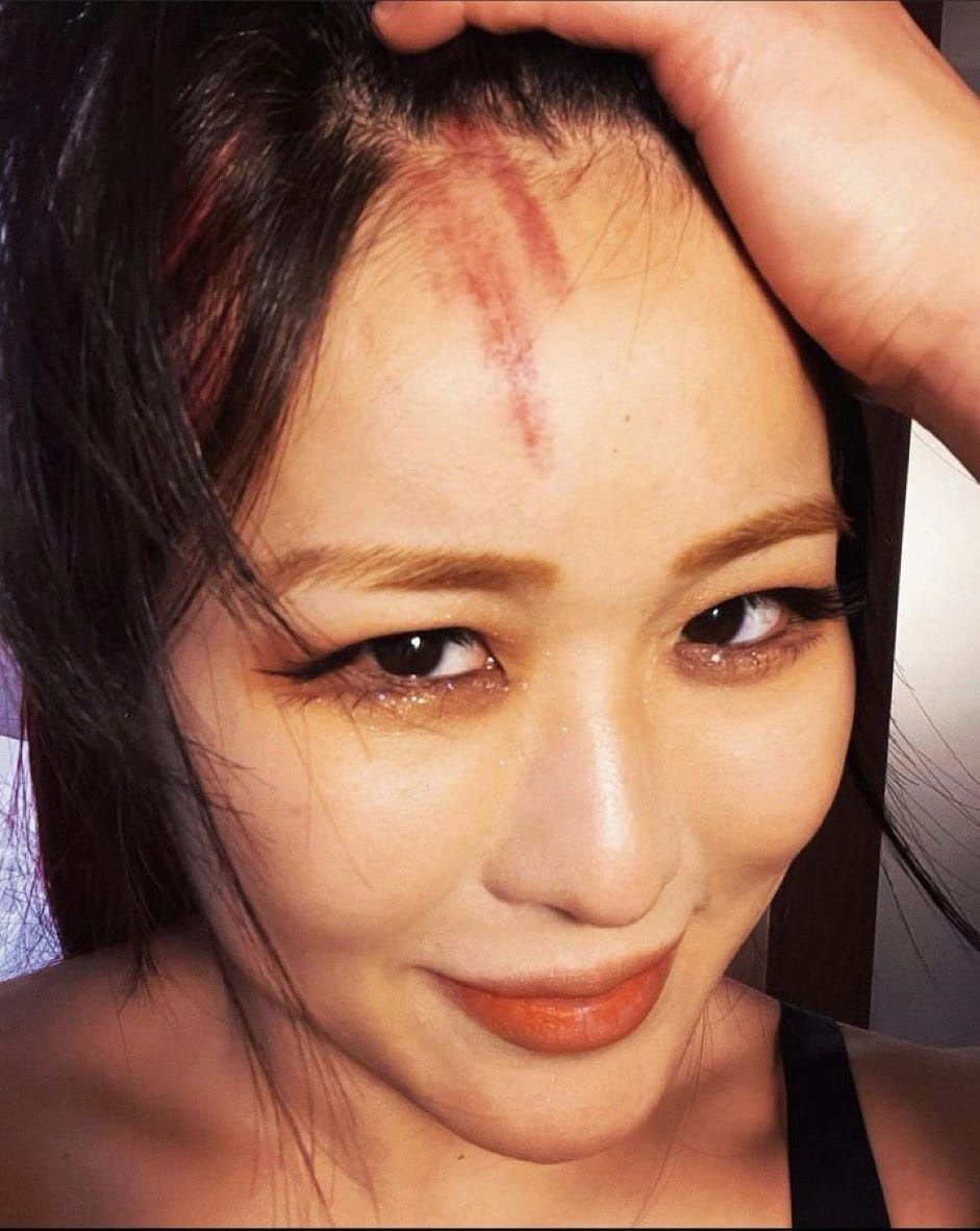 SheNeedsNoOne's tweet image. Charlotte's foot won't stop me from being the best champion in the world!