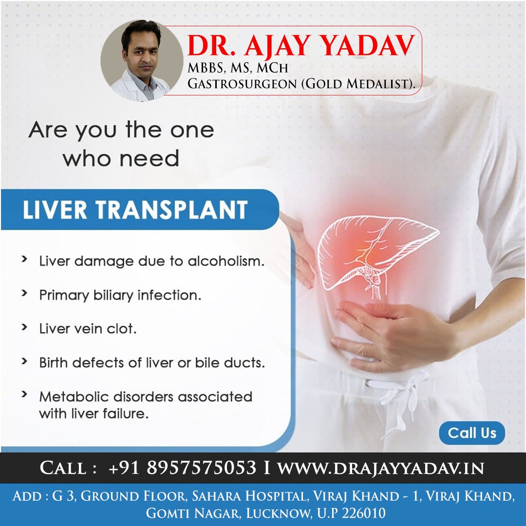 Liver Transplant
.
📆 For more information contact us:
Dr. Ajay Yadav
📞 8957575053
.
#surgery #hernia #Acidity #drajay_yadav #bariatricsurgeon #gastrosurgeon #Laparoscopysurgery #scarlesssurgery #appendixsurgrey #appendix #stone #stomach #infection #laproscopy