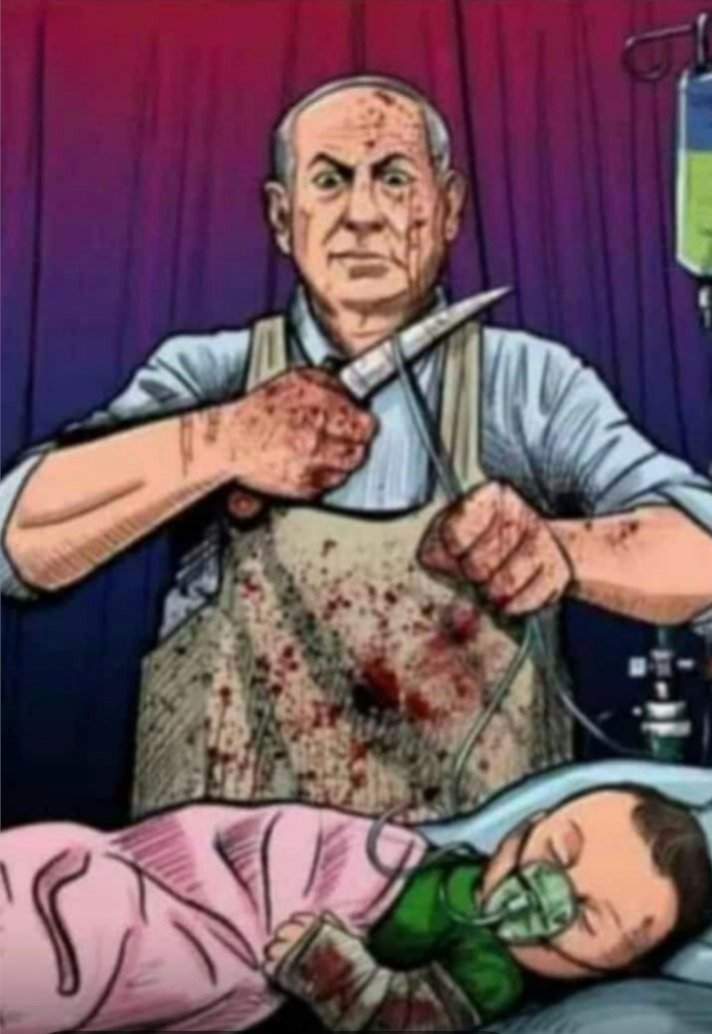 After shut everyone up.  #ZionistLobbyAttack