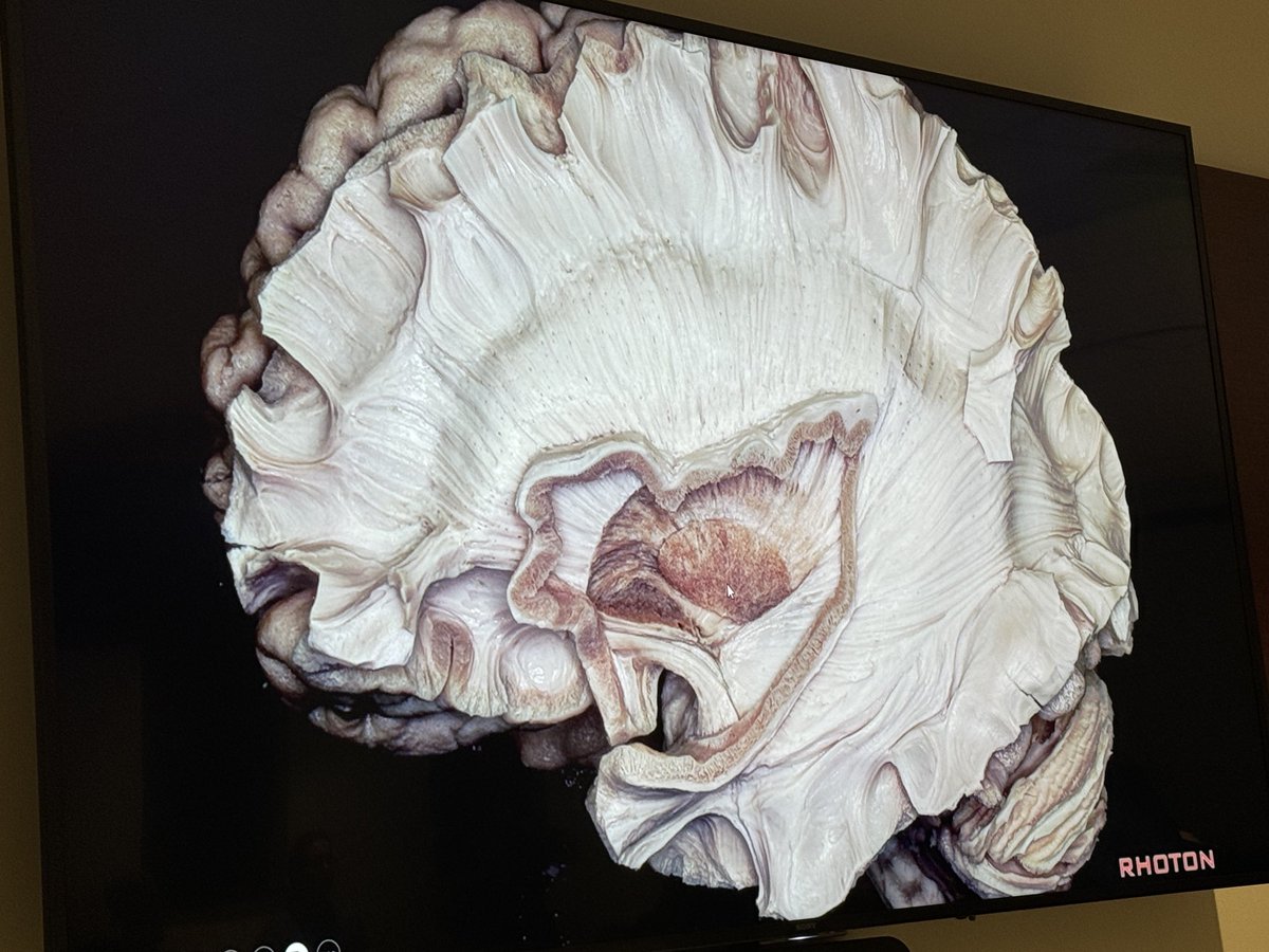 Alex Spiotta (@alex_spiotta) on Twitter photo Inspiring grands round talk today by our very own <a href="/DrJayMartinez/">Jaime Martínez, MD</a> <a href="/HolyCityNsgy/">MUSC Neurosurgery</a> <a href="/neuro_MUSC/">MUSC Department of Neuroscience</a> <a href="/MUSChealth/">MUSC Health</a> Inspiring grands round talk today by our very own <a href="/DrJayMartinez/">Jaime Martínez, MD</a> <a href="/HolyCityNsgy/">MUSC Neurosurgery</a> <a href="/neuro_MUSC/">MUSC Department of Neuroscience</a> <a href="/MUSChealth/">MUSC Health</a>