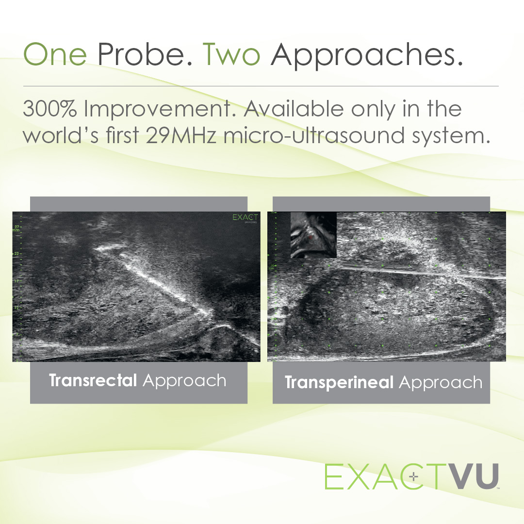Looking to transition to #TransperinealBiopsy? The #ExactVu #MicroUltrasound system supports both TR and TP approaches with a single probe, all with #29MHz for 300% higher resolution than conventional ultrasound.  
#ProstateCancer @FocalOneHIFU #ProstateBiopsy