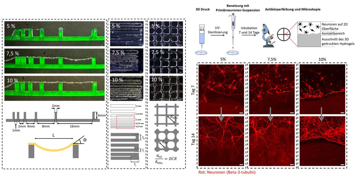 Sonja Kuth (@kuthsonja) on Twitter photo 💡Very excited to share our new <a href="/Boccaccini_Lab/">Biomaterials_Erlangen</a> <a href="/EBM_research/">ExploringBrainMechanics</a> <a href="/UniFAU/">FAU Erlangen-Nbg</a> #OpenAccess publication in <a href="/Spektrum_BIO/">BIOspektrum</a>! We explore how we can balance printability and biocompatibility during bioink development by observing the infiltration of primary neurons into different bioinks. 💡Very excited to share our new <a href="/Boccaccini_Lab/">Biomaterials_Erlangen</a> <a href="/EBM_research/">ExploringBrainMechanics</a> <a href="/UniFAU/">FAU Erlangen-Nbg</a> #OpenAccess publication in <a href="/Spektrum_BIO/">BIOspektrum</a>! We explore how we can balance printability and biocompatibility during bioink development by observing the infiltration of primary neurons into different bioinks.