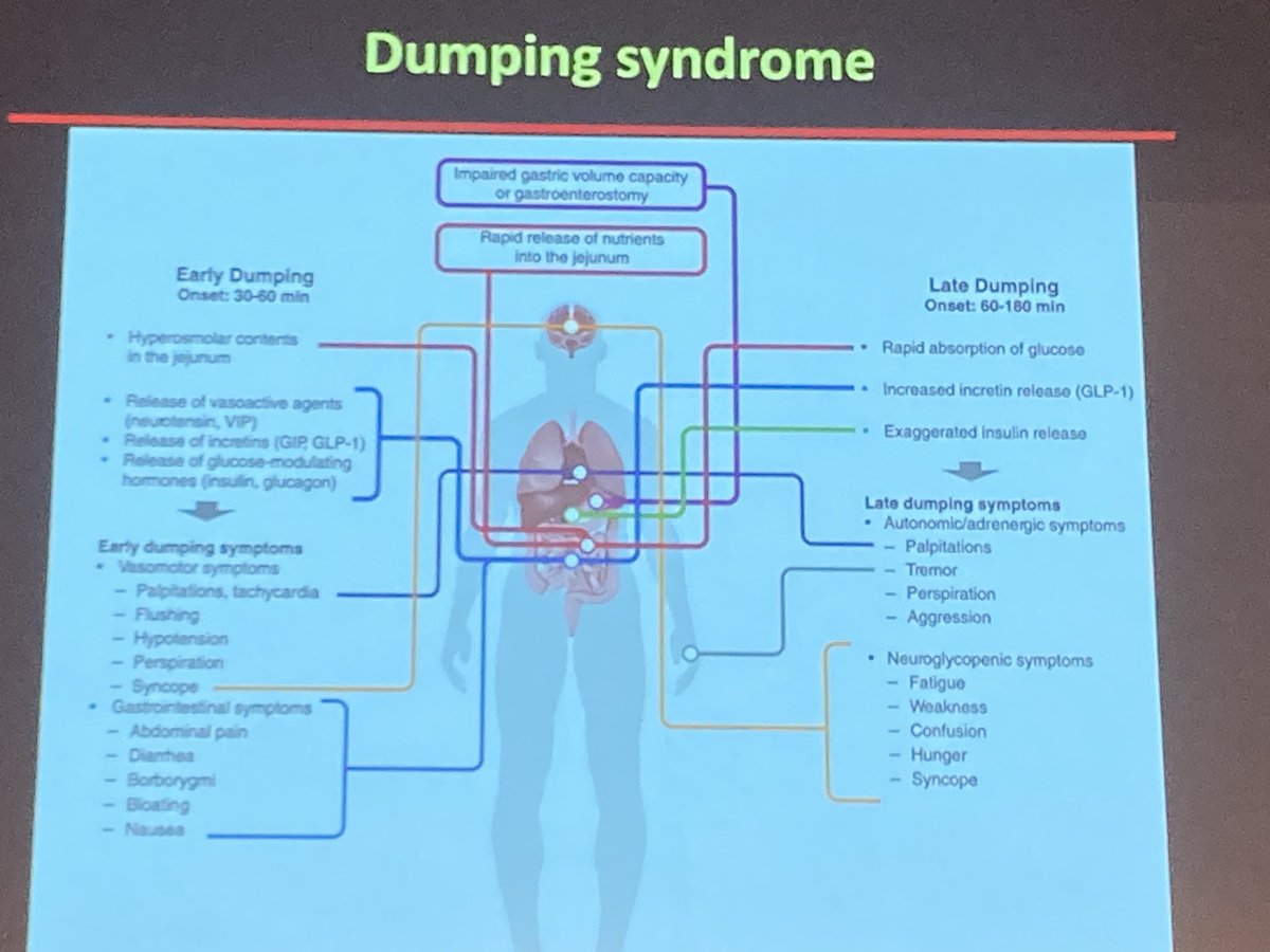 Anna Julian (@annajulianrd) on Twitter photo Joining you from the #BAPEN2023 jejunal feeding stream 🤗
First up, <a href="/AlexanderMiras/">Alex Miras</a> discussing the effects of enteral feeding on gut peptides & dumping - studies in jejunal feeding limited. Joining you from the #BAPEN2023 jejunal feeding stream 🤗
First up, <a href="/AlexanderMiras/">Alex Miras</a> discussing the effects of enteral feeding on gut peptides & dumping - studies in jejunal feeding limited.