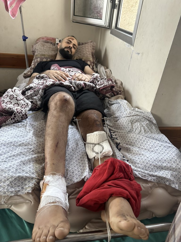 SoftWarNews's tweet photo. Seluruh keluarga saya menjadi martir, dan saya terluka, dan saya duduk di rumah tanpa perawatan atau dokter, panggul saya patah dan kaki saya tertarik. 

Saya tidak bisa bergerak dan saya harus tidur telentang sepanjang waktu. Saya harus menjalani operasi yang tidak saya jalani.. https://t.co/qcSM27i2RH