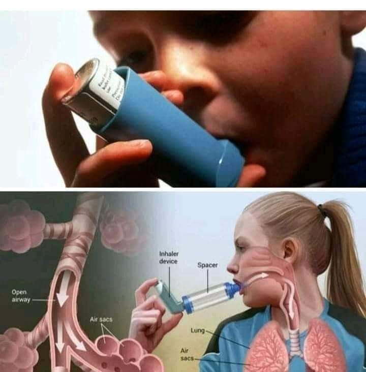 Prince_Fynnz's tweet image. ASTHMA:
Get some seeds of mango, cut it into pieces and keep under the sun to dry. Grind all to powder. Put one spoon of the powder into a glass cup of water, stir it and drink. Once in a
day for 3-4 weeks .