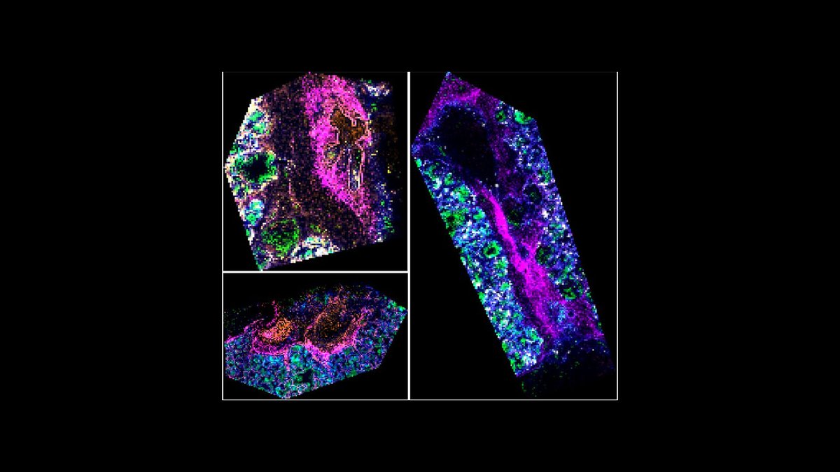 NIH Common Fund (@nih_commonfund) on Twitter photo DYK that lipids, long chains of fatty acids, are inside your lungs & prevent cells from collapsing when you exhale? #_hubmap researcher Dr. Brittney Gorman <a href="/PNNLab/">Pacific Northwest National Laboratory</a> shows where different #lipids reside in the #lung w/MALDI-MSI. It will make you insane in the membrane! DYK that lipids, long chains of fatty acids, are inside your lungs & prevent cells from collapsing when you exhale? #_hubmap researcher Dr. Brittney Gorman <a href="/PNNLab/">Pacific Northwest National Laboratory</a> shows where different #lipids reside in the #lung w/MALDI-MSI. It will make you insane in the membrane!