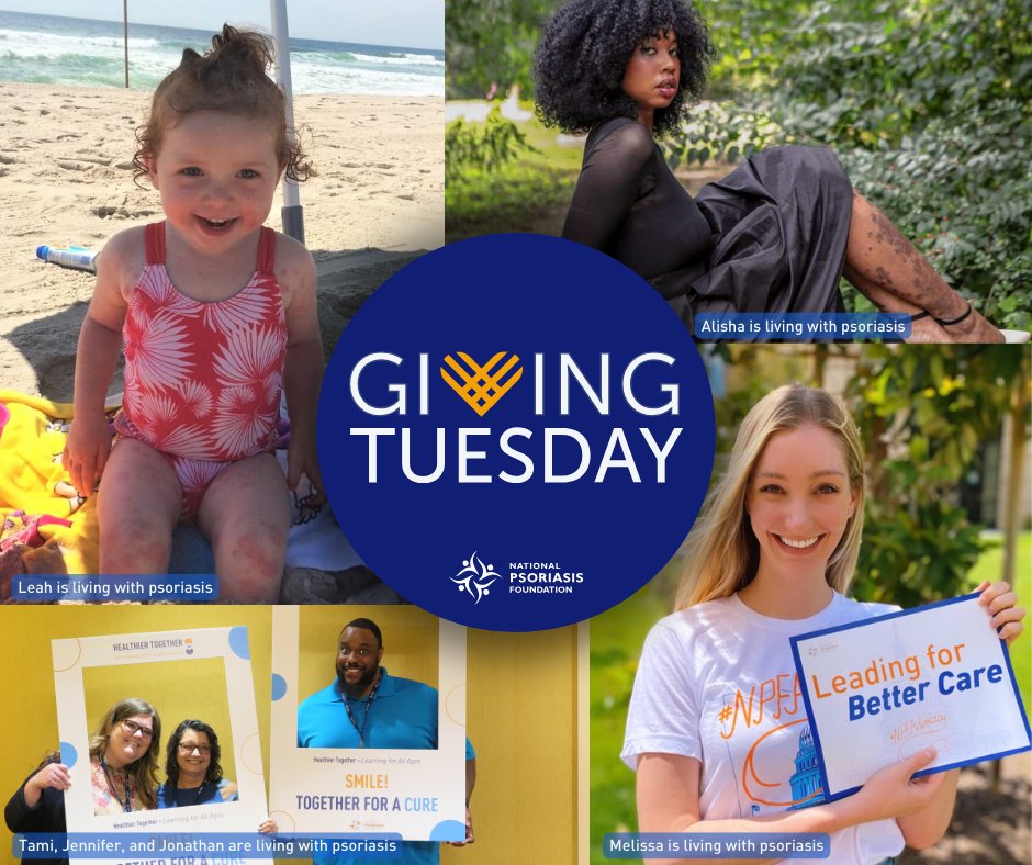 #GivingTuesday is here and thanks to a generous donor your gift today is doubled! WIll you make a gift to help improve the lives of those living with #psoriaticdisease? psoriasis.org/donation-socia…