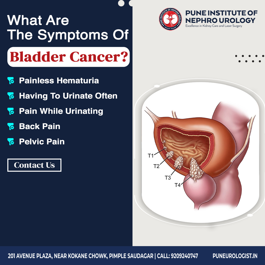 What Are the Symptoms of Bladder Cancer?

- Painless hematuria
- Having to urinate often
- Pain while urinating
- Back pain
- Pelvic pain

🌏puneurologist.in
📲 9209240747

#bladdercancer #BladderCancerAware #bladdercancersucks #bladdercanceraware #cancer #câncer #Pune