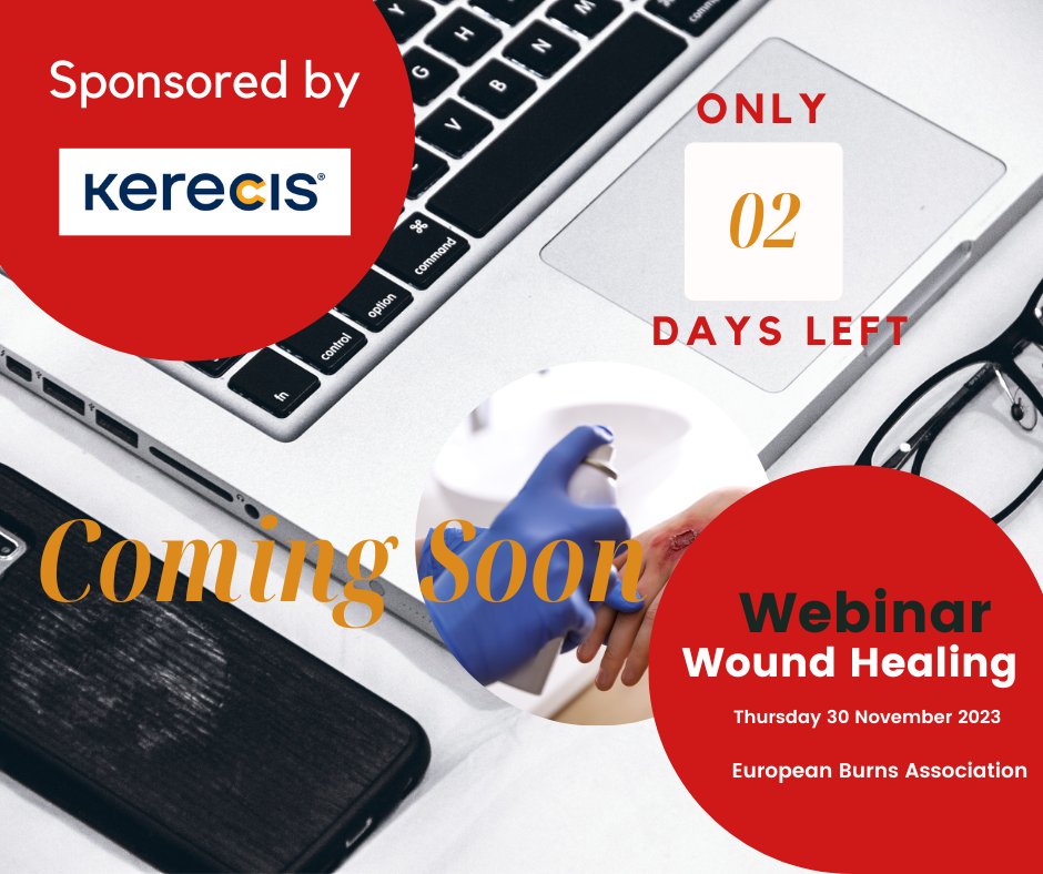 Only 2 days left before the 8th #EBA #Webinar will start! It's not too late to register via: hubs.li/Q02bblwF0 You can find the program via the following link hubs.li/Q02bbNRj0 Hope to see you online!