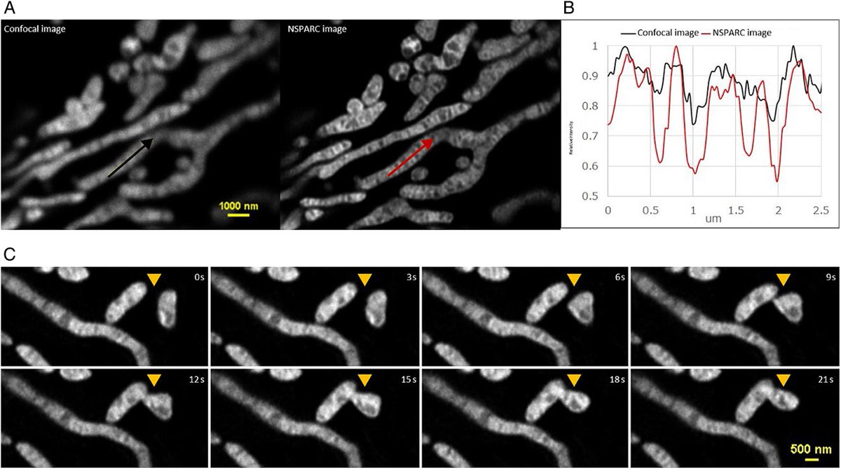 Our own Dr. Sabrina Delattre has an article featured in @MicroscopyToday on the #NSPARC #SuperResolution #ImageScanningMicroscopy detector for our AX / AX R #Confocal #Microscopy system. Image of live mitochondria acquired with NSPARC. Click for article: bit.ly/3Gl358v