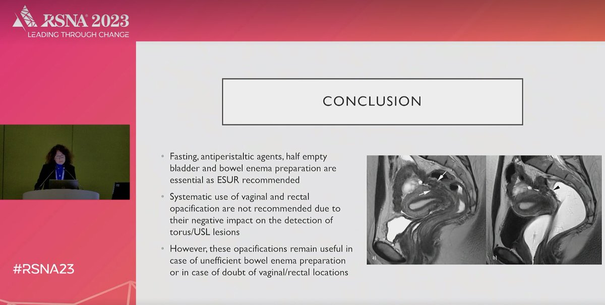 La <a href="/SifemF/">SIFEM imagerie de la femme</a> est présente au <a href="/RSNA/">RSNA</a> 2023 avec une très belle présentation de la Présidente <a href="/NaggaraIsabelle/">Isabelle Thomassin-Naggara</a>
