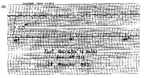 #OTD 11/28/1967: J. Bell & A. Hewish of the Mullard Radio Astronomy Observatory discovered the first #pulsar, jokingly nicknaming it LGM-1 (for 'little green men') 👽 pulsar.ca.astro.it/pulsar/PSR.html   #astronomy #space #radioastronomy #science