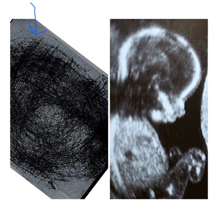 BCEsupernova's tweet image. You are here. #CreationPattern #SacredGeometry