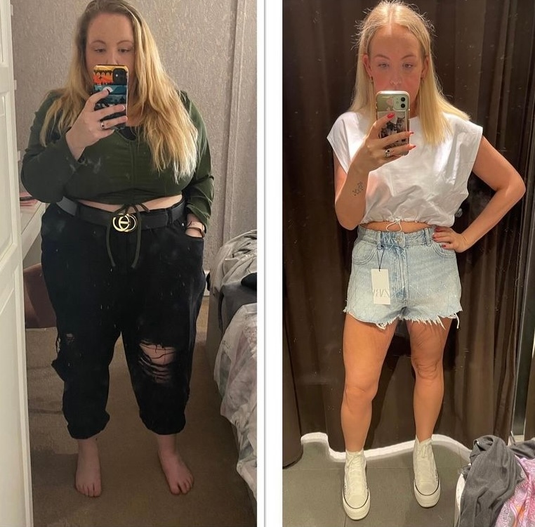 REPOST @amy_gets_sleeved '💫TRANSFORMATION TUESDAY💫' Inspirational Amy lost over 10 stone following her weight loss surgery with Tonic 🤩 Get in touch with our friendly team today to start your weight loss journey. #GivingBackLives ⁠