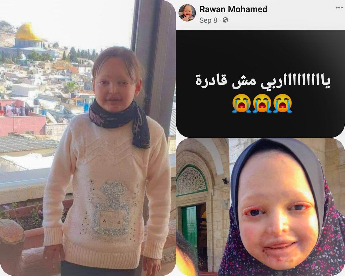missfalsteenia's tweet image. My heart is so heavy right now. 

This is Rawan Mohamed she spent many years on a medical journey between Gaza and Jerusalem, she had a rare disease.

Due to Gazas condition &amp;amp; lack of medical permits, Rawan passed away. Her last few Facebook posts expressed her pain &amp;amp; misery.