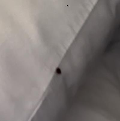 NikiTheStylist's tweet photo. had the worst experience checked in @bestwestern in Minden, La and it was infested with bed bugs and they had the nerve to ask me if the pillow was mine because it didn’t look like their bedding so I made them come check the room, and there will bed bugs everywhere! DISGUSTING! https://t.co/h3XnVy9Hgg