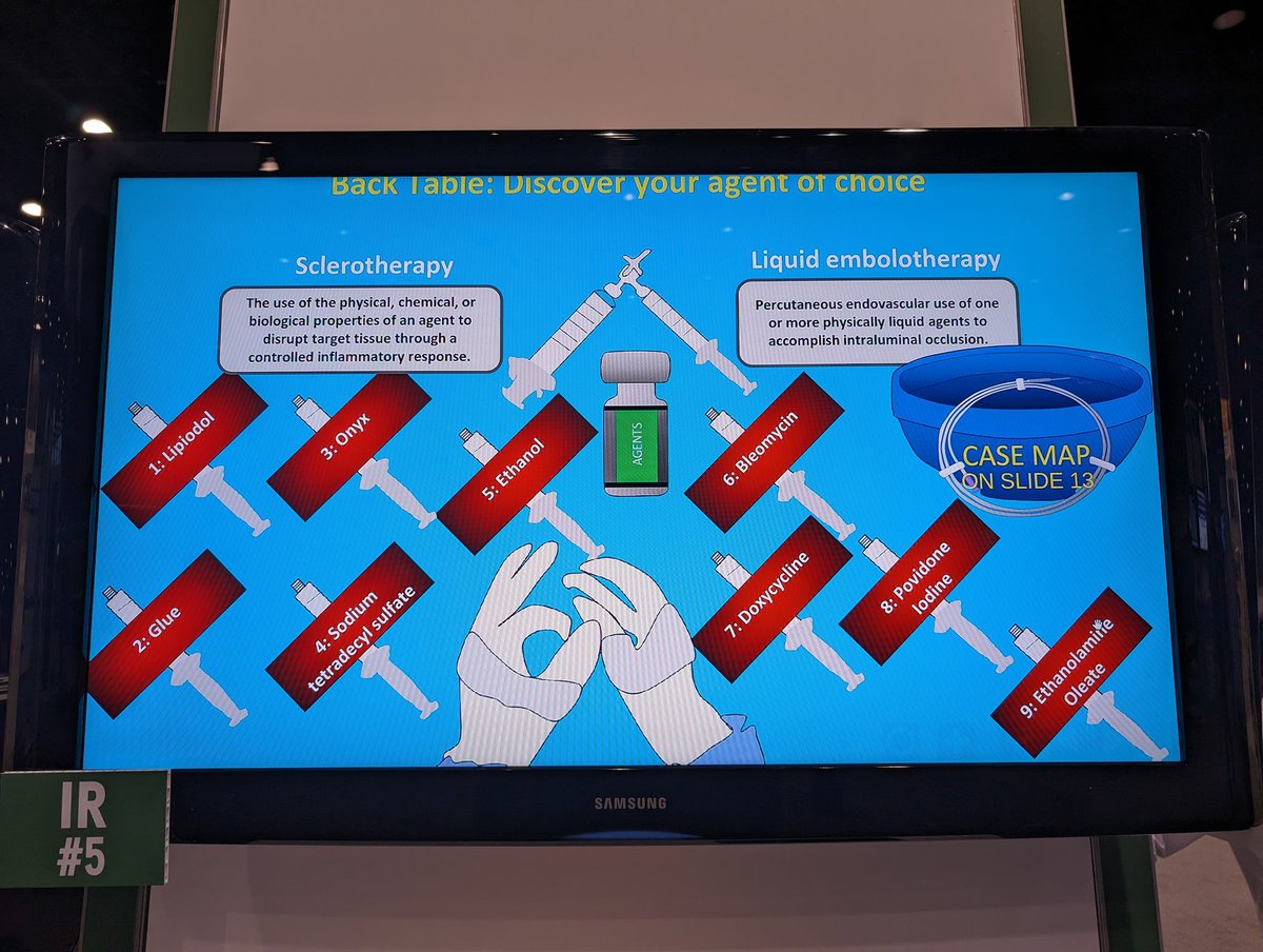 FredBertinoMD's tweet image. A comprehensive review of the gamut of liquid agents that #IRad used for embolization procedures and their imaging appearances from superstar #IRadres Keith Ameyaw @NYURadRes @nyuVIR @NYUImaging #RSNA23 #RSNA2023