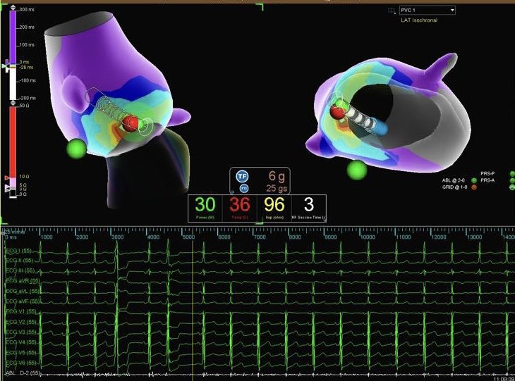 Jaylynn Markey tweet media