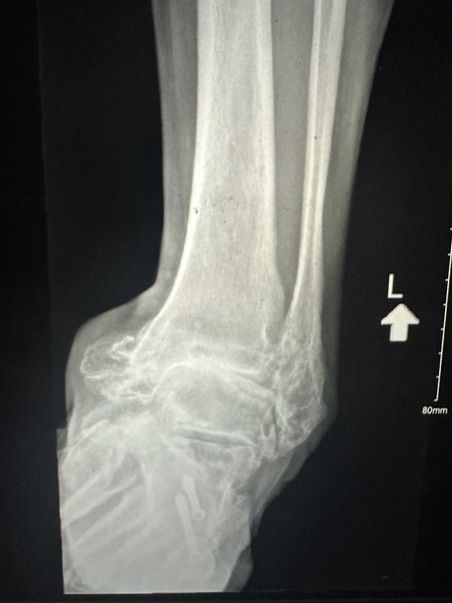 Christopher Miller, MD, MHS, FAAOS tweet media