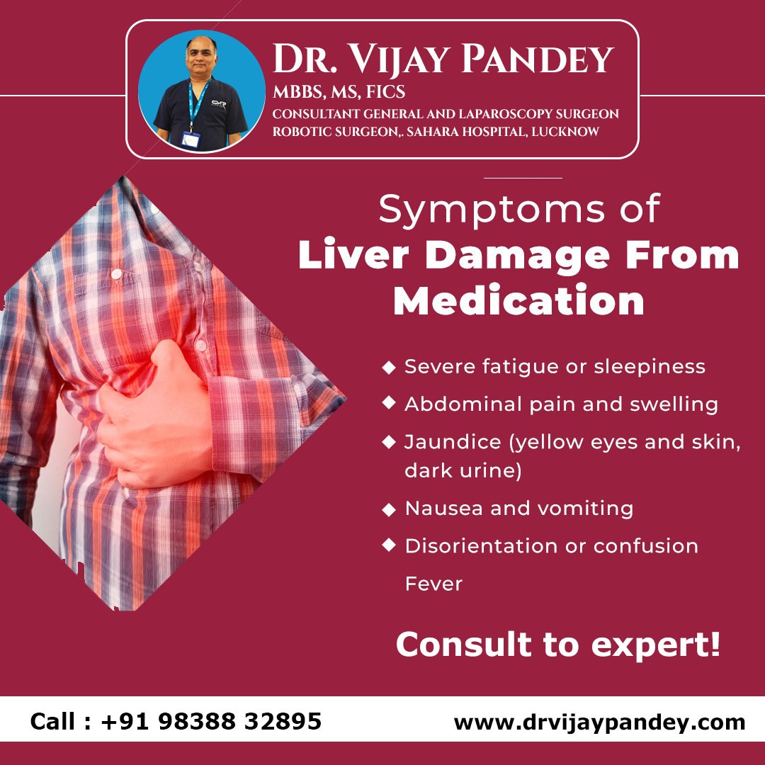 Symptoms of Liver Damage From Medication
.
📆 For more information contact us: 
Dr.  Vijay Pandey 
General & Laparoscopic Surgeon
📞 9838832895
.
#laproscopicsurgeon #roboticsurgery #livercare #liverfunction #pancreaticcancer #stomachcancer #fattyliver #GERDTreatment #Acidity