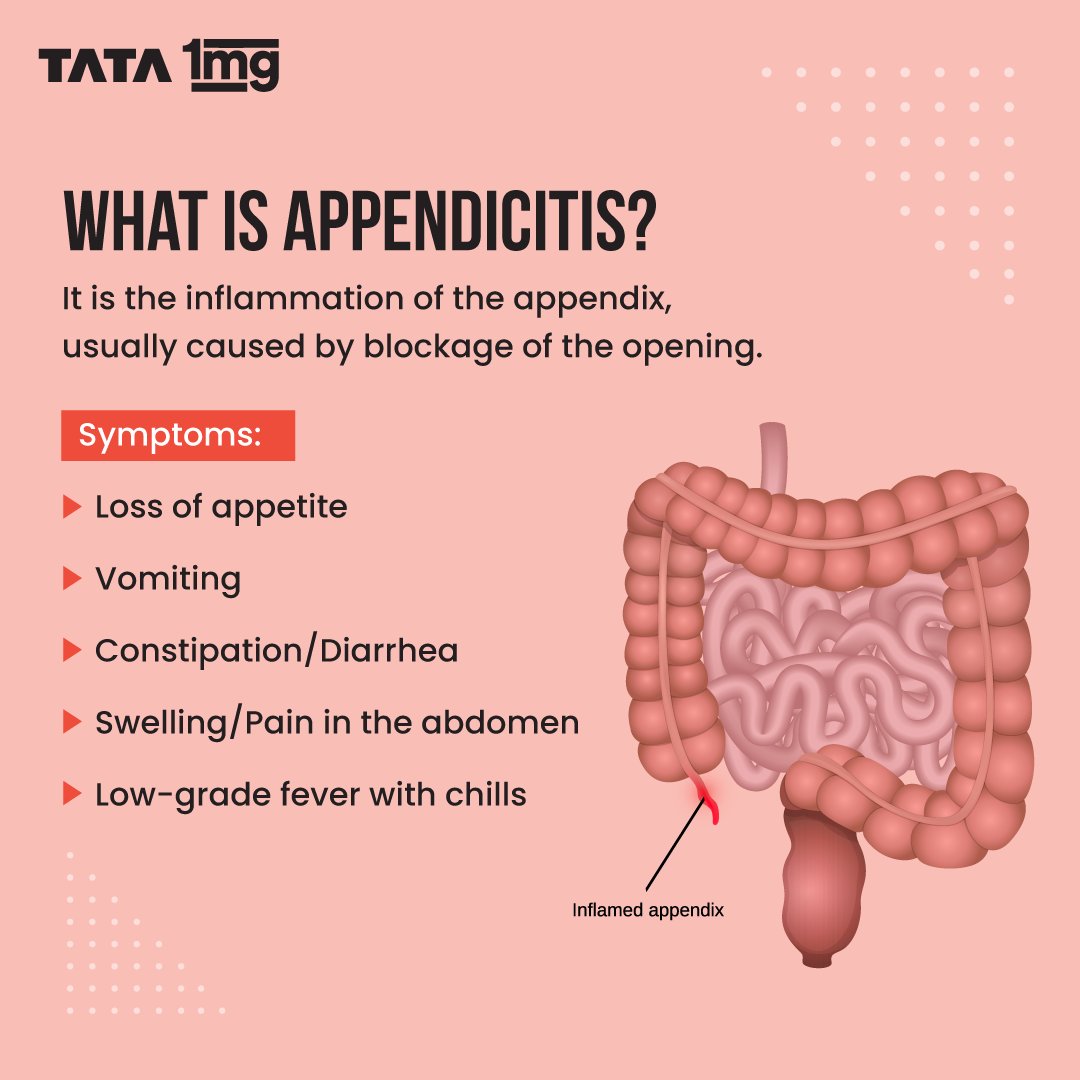 1mgOfficial's tweet photo. Understand the basics of Appendicitis, from its definition to risk factors and potential home management.

Share it with your friends and family &amp; empower them with knowledge.

#Appendicities #appendixpain #appendicitissymptoms #Tata1mg #BringingCareToHealth https://t.co/DN0t59y84F