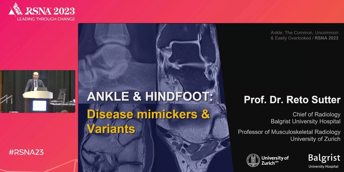 It was a pleasure to be part of the Educational Course on the Ankle at #RSNA23. Thanks to all for attending the session which covered both common, uncommon & easily overlooked diseases of the #ankle - now it is also available on demand in the @RSNA App! #MSKrad