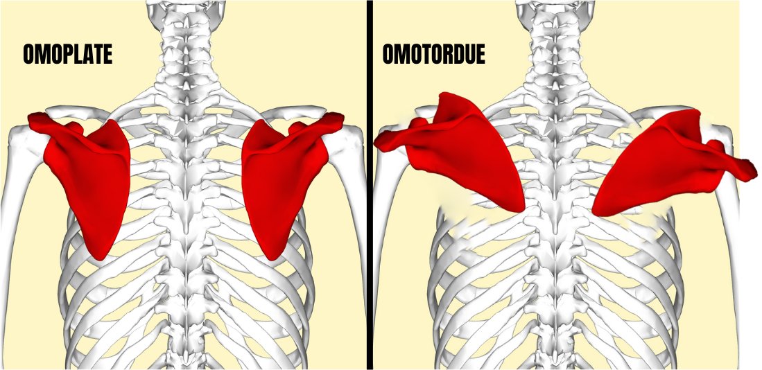 rplusplus's tweet image. Envie de vous partager nos petites blagues et jeux de mots spécial corps humain !😂
#jeuxdemots #MedTwitter 
A dérouler 🔽
1) Omoplate💪