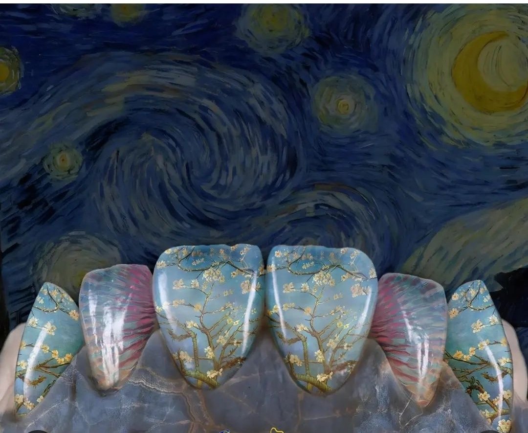 bộ nhá cho fan của Val Gogh.
#dental #nhakhoa