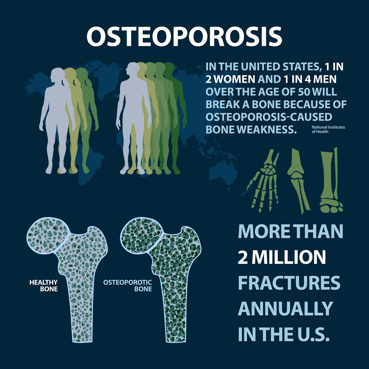 🦴 Aging increases osteoporosis risk. 📊 Get a bone density test for bone health after 50. #HealthChecks #OsteoporosisPrevention