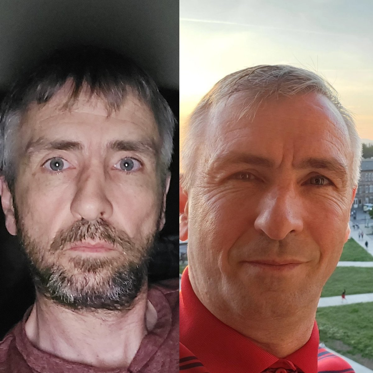 Just reached 20K Followers, humbled having so many follow my story. Let me introduce myself, My name is Peter, on the left broken by stigma, homeless & drug dependent, on the left the result of support & love. If you see this, be kind, say hi 👋 #SupportDontPunish always 💜