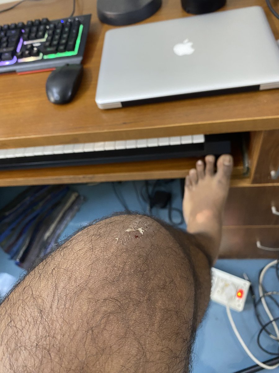 Kailas425's tweet photo. 🚨 Urgent @TheSleepCompany Complaint 🚨

Bought "SmartGRID Stylux Chair" on Nov 29, '23. 4 PM, crucial part broke, causing injuries. 🤕 Contacted customer care, shared pics &amp; videos. They discussed replacement but ignored injuries.

#SleepCompany #CustomerSafety #consumerRights https://t.co/Yc3cWviPd2
