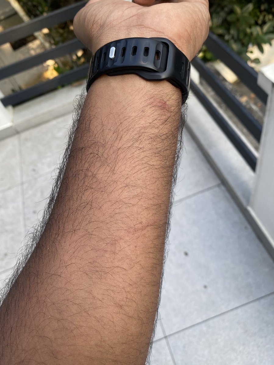 Kailas425's tweet photo. 🚨 Urgent @TheSleepCompany Complaint 🚨

Bought "SmartGRID Stylux Chair" on Nov 29, '23. 4 PM, crucial part broke, causing injuries. 🤕 Contacted customer care, shared pics &amp; videos. They discussed replacement but ignored injuries.

#SleepCompany #CustomerSafety #consumerRights https://t.co/Yc3cWviPd2