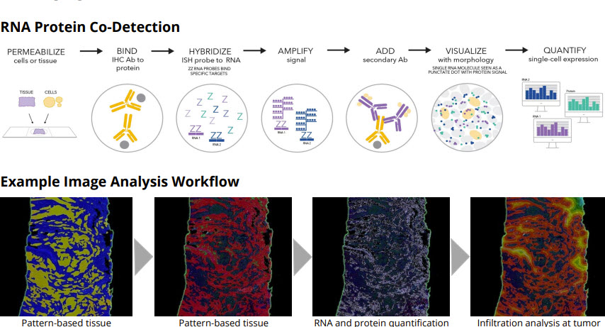 Indica Labs (@indica_labs) on Twitter photo If you missed our collaborative poster on RNA-protein co-detection & analysis with <a href="/ACDbio/">Advanced Cell Diag.</a> at #SITC23 click the link to view online now!
cdn.indicalab.com/wp-content/upl…
#pathtwitter #digitalpathology #spatialbiology #AdvancingYourRNAISH #HALOai #AdvancedCellDiagnostics #IndicaLabs If you missed our collaborative poster on RNA-protein co-detection & analysis with <a href="/ACDbio/">Advanced Cell Diag.</a> at #SITC23 click the link to view online now!
cdn.indicalab.com/wp-content/upl…
#pathtwitter #digitalpathology #spatialbiology #AdvancingYourRNAISH #HALOai #AdvancedCellDiagnostics #IndicaLabs