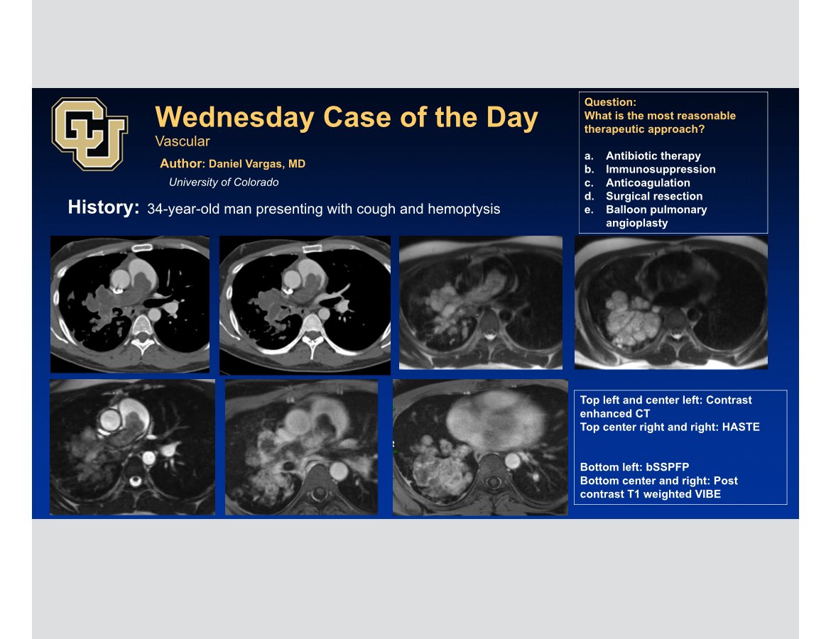 Did you check out and answer today’s Vascular Case of the Day?
#RSNA23 <a href="/RSNA/">RSNA</a> <a href="/CURadiology/">CU Radiology</a>