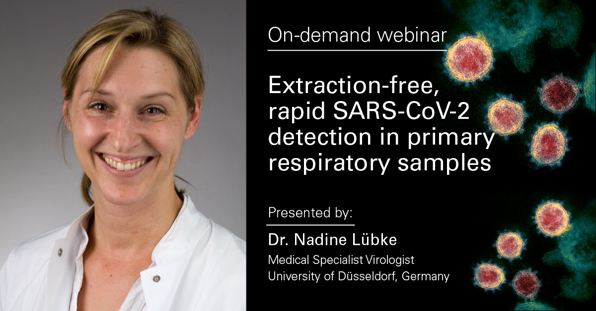 TakaraBioUSA's tweet image. Scenes from a nimble #PandemicResponse—watch now: ow.ly/OAJ850OViLZ

Dr. Nadine Lübke discusses how her team developed a fast, easy #RTqPCR assay to detect #SARSCoV2 during routine staff surveillance at the University Hospital of Düsseldorf. #WebinarWednesday