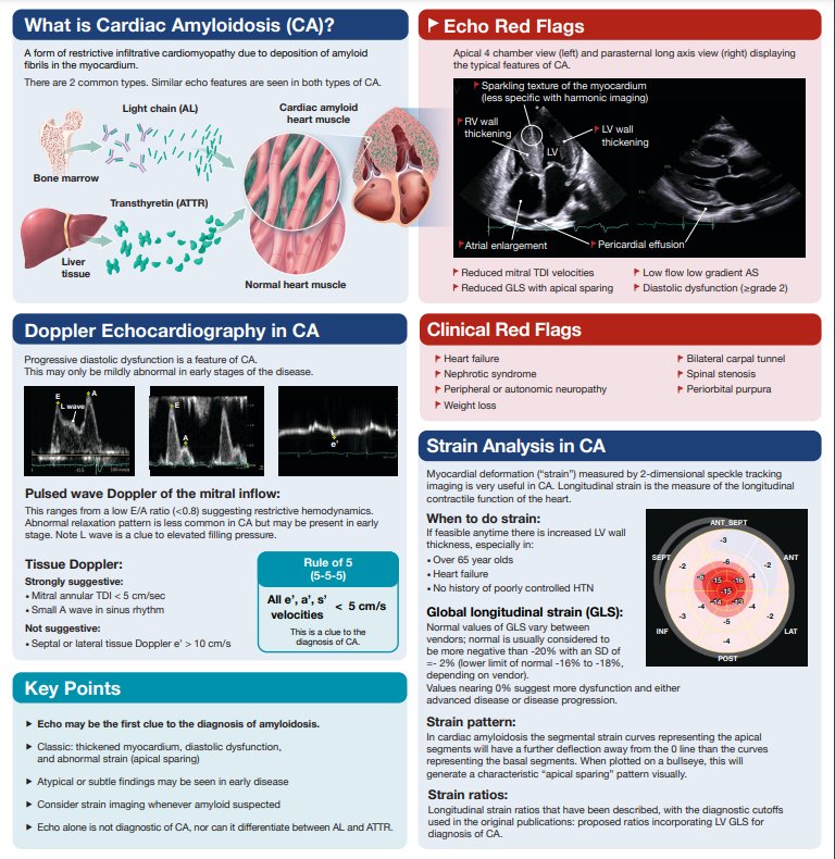 Echocardiography for Cardiac Amyloidosis poster that was produced by #ASE : bit.ly/49S70qZ
#MedEd #cardiology #medtwitter #CardioTwitter #CardioEd #CardioTuiteros #echofirst