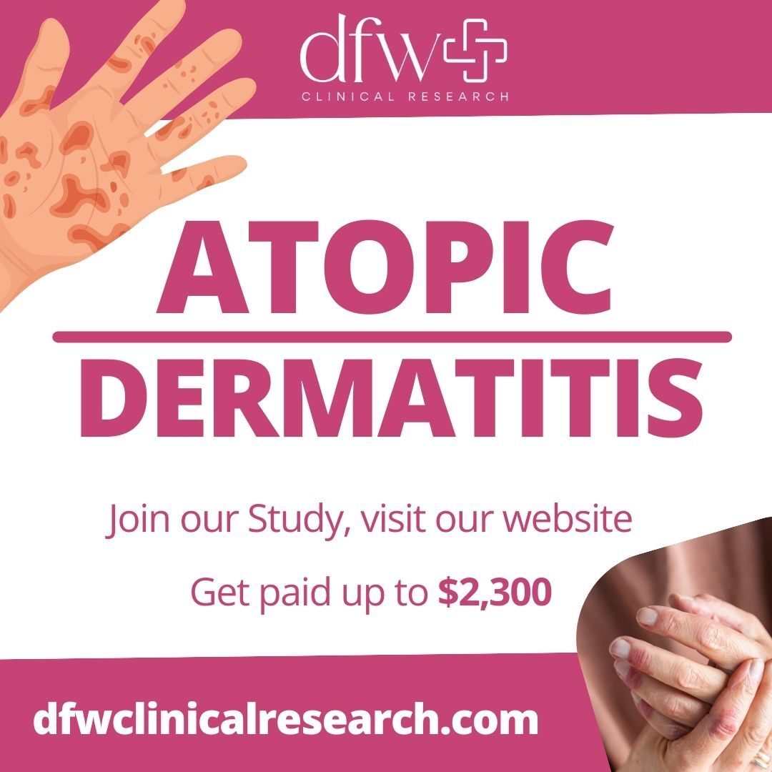 Suffering from Eczema? Join our research in the #DFW area to explore effective treatments. Compensation provided for eligible participants. Sign up today! 💰 

dfwclinicalresearch.com 
or
Call: 469-225-5800

#AtopicDermatitis #EczemaResearch #DFWStudies