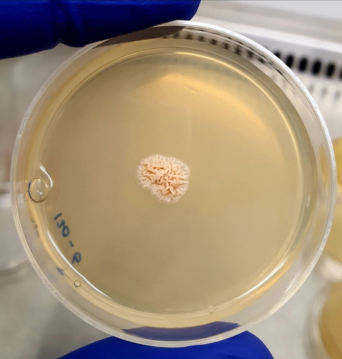AamerDr's tweet photo. كل الاعضاء تنمو في المعمل حتى المخ😅🧠

بكتيريا من التربة ونمت بالشكل ده https://t.co/bUCXHFGXej