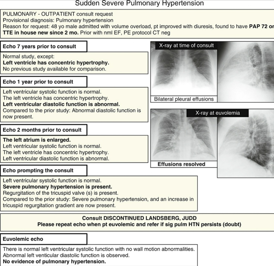 What keeps  blood flowing forward  through the lungs in LHF? What maintains the PV waterfall? How does LHF➡️RHF

Biventricular Heart Failure Reflex
#pulmonary #meded #MedTwitter #CriticalCare #cardiotwitter #internalmedicine #hospitalist #cardiology #PulmonaryHypertension PRTIYL