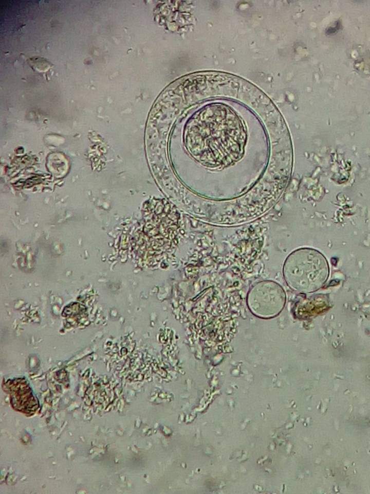 mICROBIOsh's tweet image. Imágenes de un general de heces 💩 de un paciente con diferentes tipos de parásitos; échale un vistazo a este hermoso zoológico donde verás, Quistes de Entamoeba coli, Entamoeba histolytica, Giardia lamblia, Iodamoeba butschlii, huevecillos de Hymenolepis nana