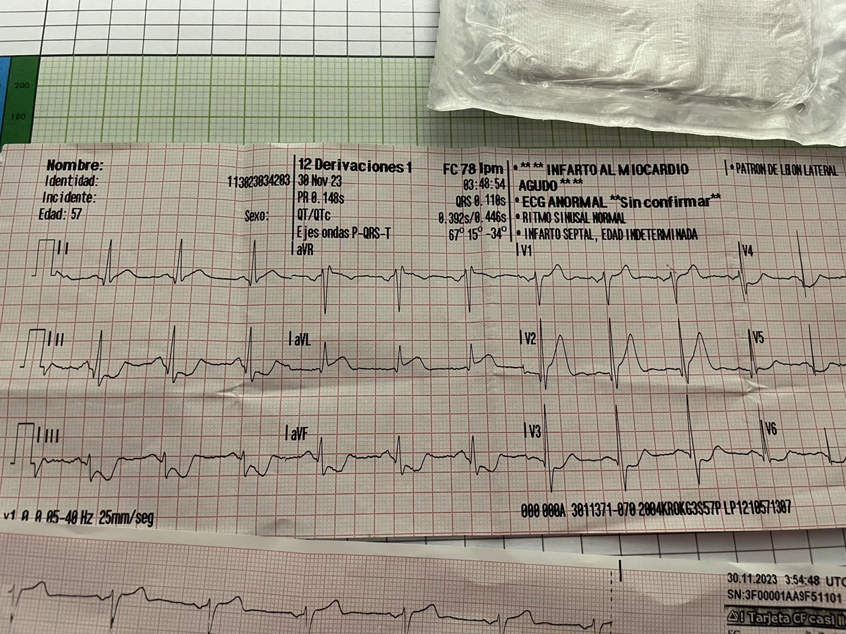 ¿La pasión por el fútbol como factor de riesgo cardiovascular?