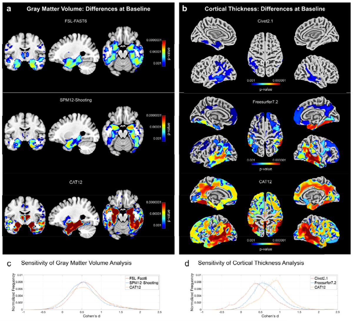 Impressive new guided tour of the brain imaging analysis toolbox, CAT12 -  by @ChristianGaser + Team 🧠🧠 !  👉biorxiv.org/content/10.110…