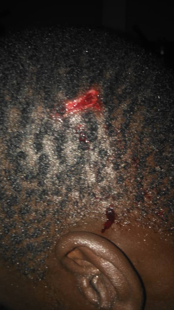 CitizenWakura's tweet photo. In Mabvuku Tafara the @ZANUPF_Official losing councillor and Scott campaign team are busy unleashing violence to our campaign team in Ward 9. We need elections not WAR @edmnangagwa @PoliceZimbabwe https://t.co/0zTBF5ZsUD