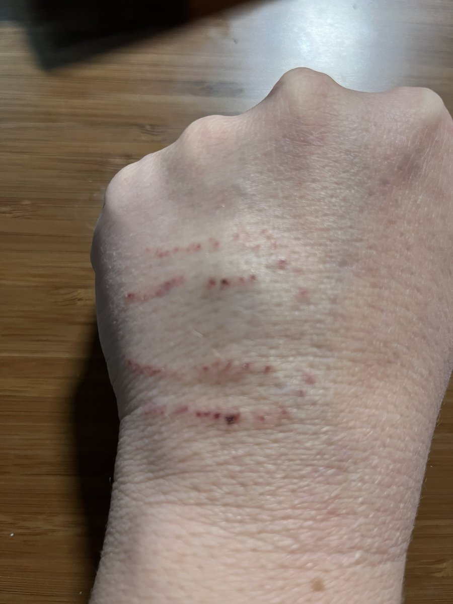 prettysami's tweet photo. Feeding my boa tonight I dropped the rat, and like a dummy I reached in to grab it and got tagged. Then I freaked out and pulled back instead of letting him let go. It hurt like a bitch. Lesson learned lol https://t.co/BenqngqtlQ