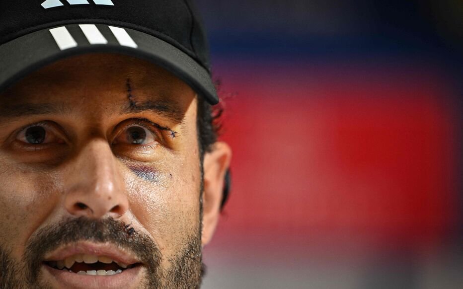 LRevDuSport's tweet photo. [ Football ⚽️]

🔴Fabio grosso est mis
 à la porte par l'OL 👋

Voici les favoris pour le remplacé : 

- Bruno Genesio
- Igor Tudor
- Jorge Sampaoli

#TeamOL #OlympiqueLyonnais 

@FabriceHawkins https://t.co/mgCdY82vb4